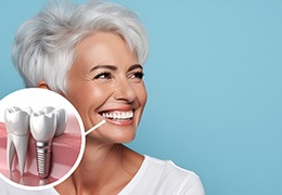 Smiling woman next to illustration of a dental implant