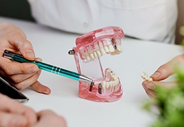 Dentist using model to explain dental implants